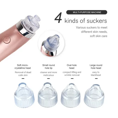 Shophably® Blackheads Remover Vacuum