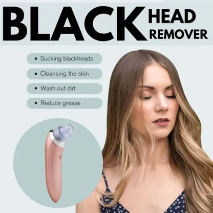 Shophably® Blackheads Remover Vacuum